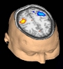 fMRI